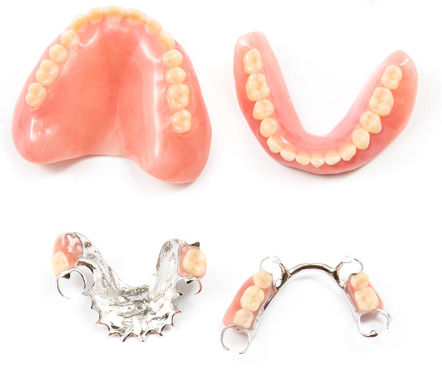 Uw kunstgebit – Dentaalfix